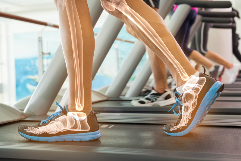 Legs walking on a treadmill, with graphical bone x-ray over legs